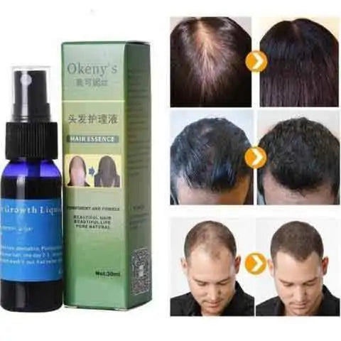 Organic Hair Growth Essence - Choose Victor
